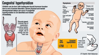 congenital-hypothyroidism1