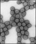 Electron micrograph of rotavirus