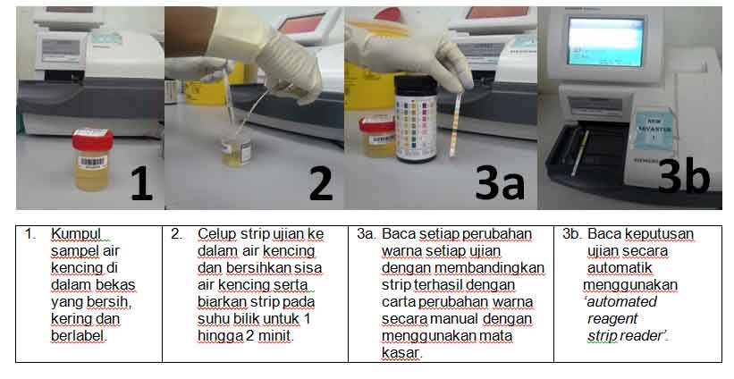 Ujian-urin1