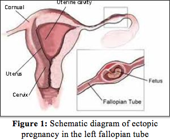 Menstrual Cycle Physiology - PORTAL MyHEALTH