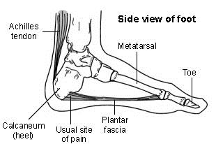 Physiotherapy for Plantar Fascitis - PORTAL MyHEALTH
